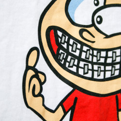 got-braces-detail_got-braces_standard-screen-printing Got Braces | Detailed Logo On Standard Screen Printing | Impressionz Printing